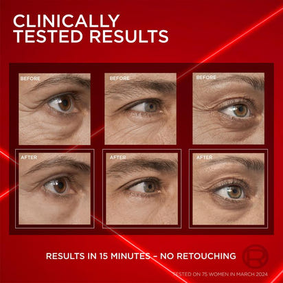 Louvre Revitalift™ Eye Cream